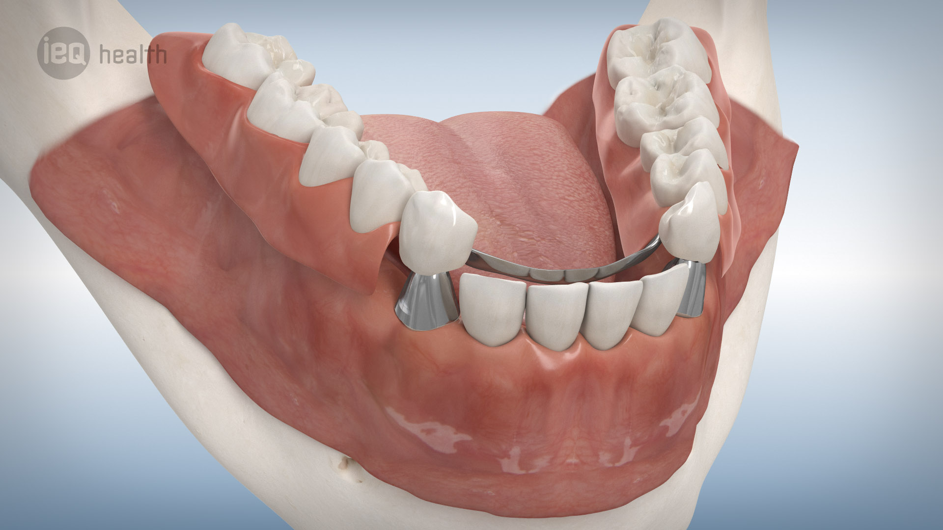 3D-Animation